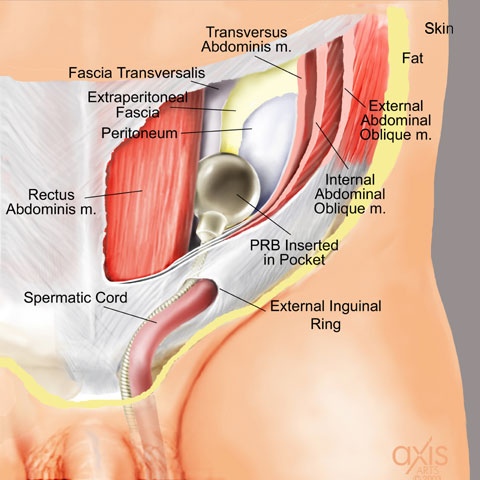 Copyright 2004 Axis Arts