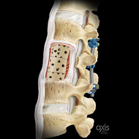 Copyright 2004 Axis Arts