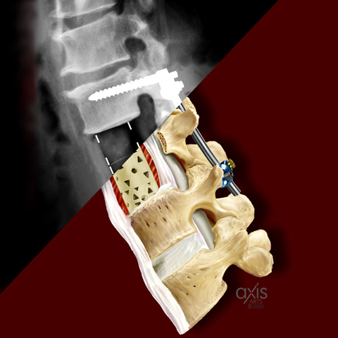 Copyright 2004 Axis Arts