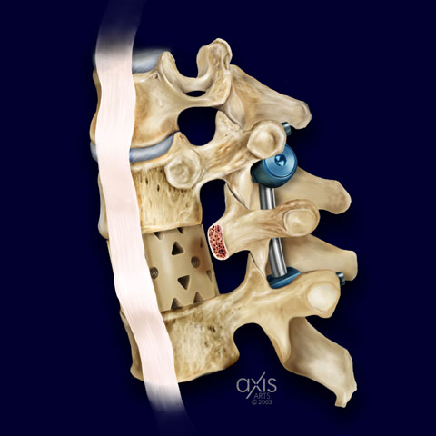 Copyright 2004 Axis Arts