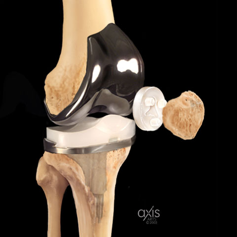 Copyright 2004 Axis Arts