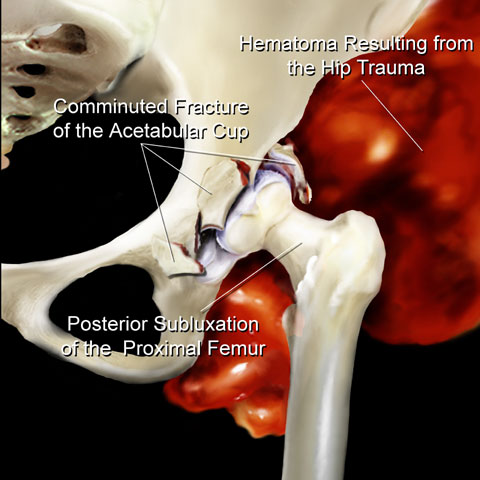 Copyright 2004 Axis Arts