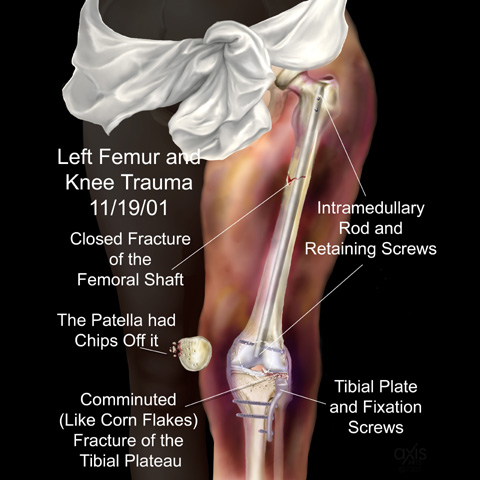 Copyright 2004 Axis Arts