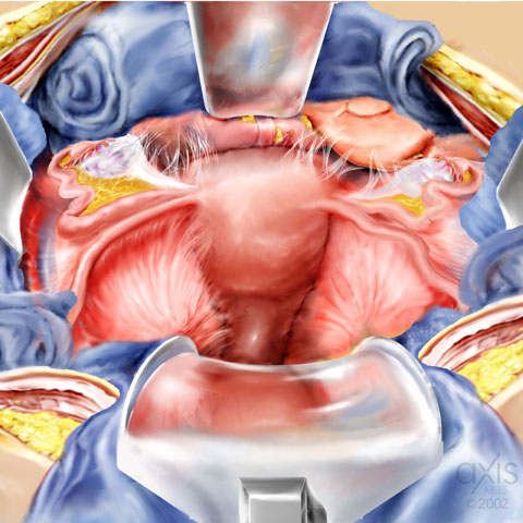 Copyright 2004 Axis Arts