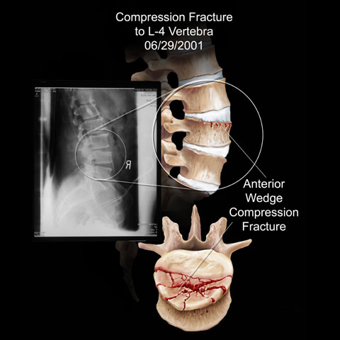 Copyright 2004 Axis Arts