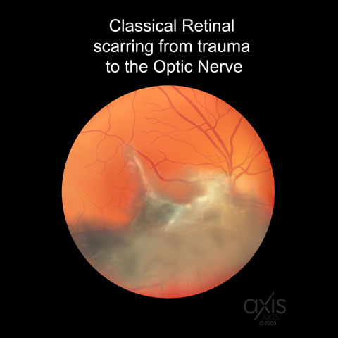 Copyright 2004 Axis Arts