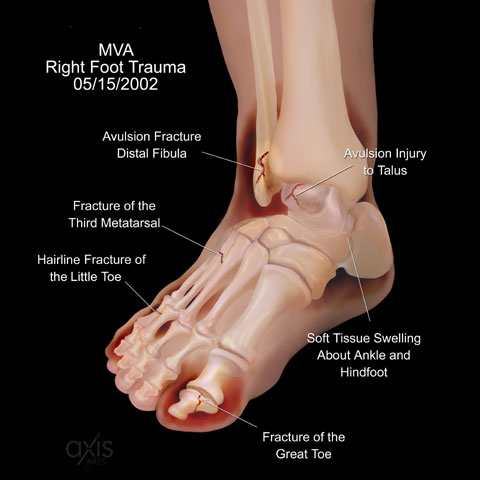 Copyright 2004 Axis Arts