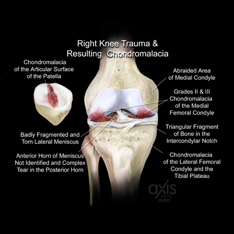 Copyright 2004 Axis Arts