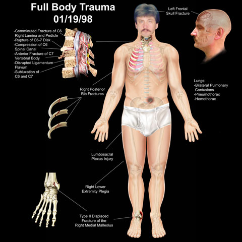 Copyright 2004 Axis Arts