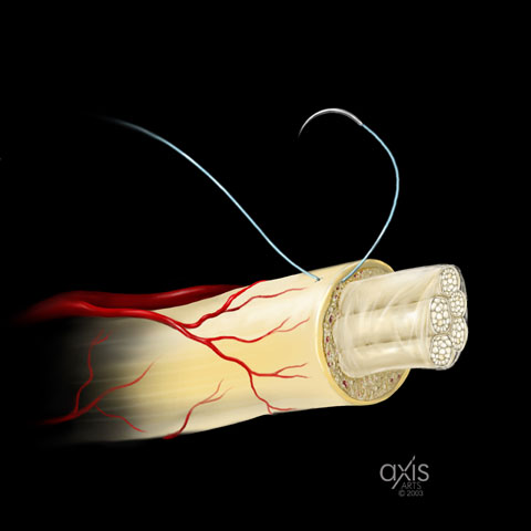 Copyright 2004 Axis Arts