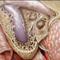 thumbnail of medical illustration