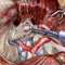 thumbnail of medical illustration